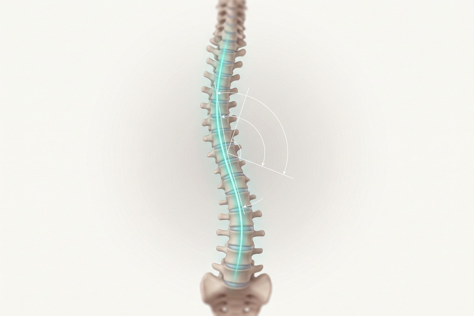 أخصّائي جنف يقيس انحناء العمود الفقري على صورة أشعة سينية في عيادة بمسقط، عُمان