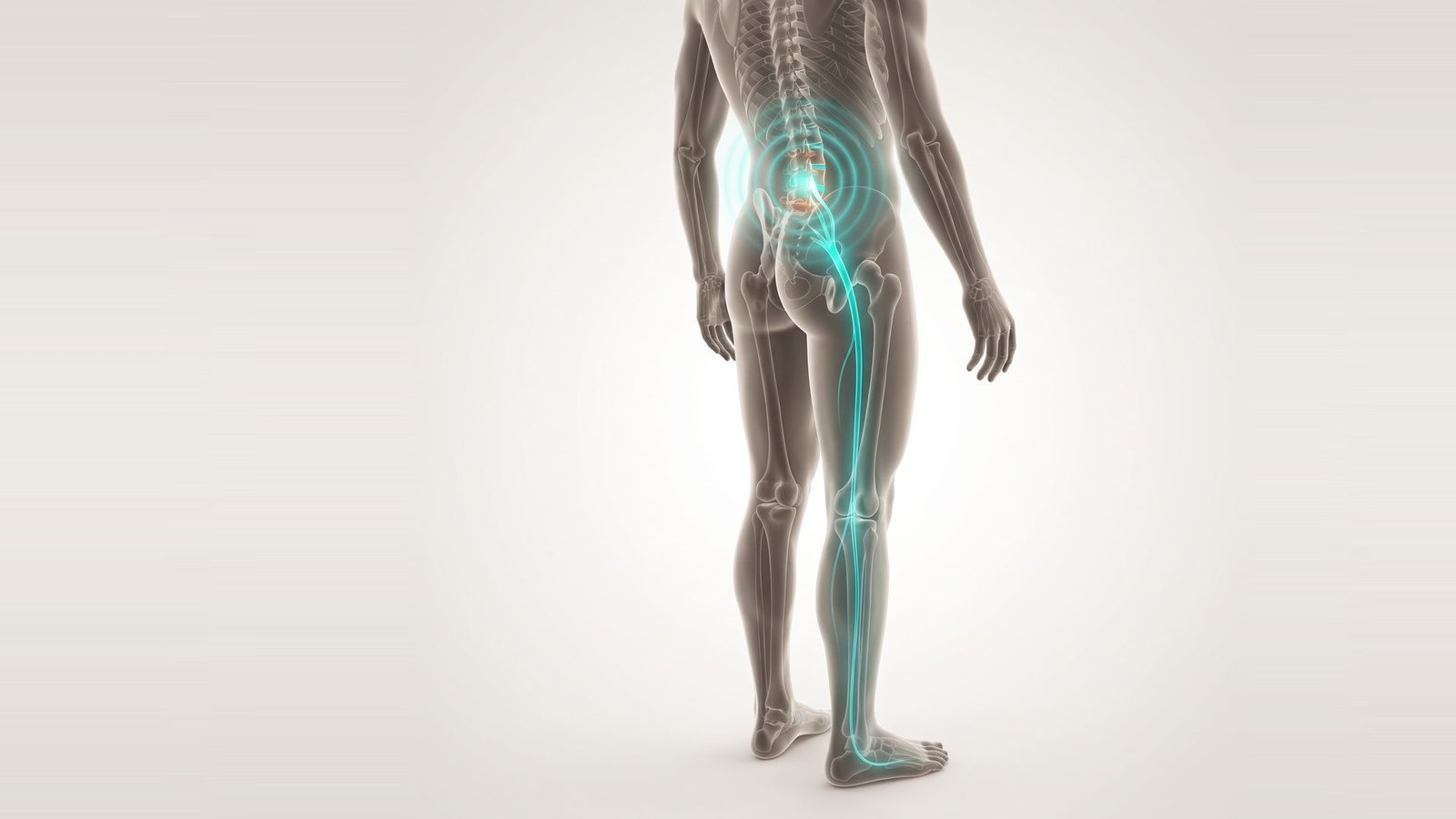 Sciatic nerve pain radiating from the lower spine down the back of the leg