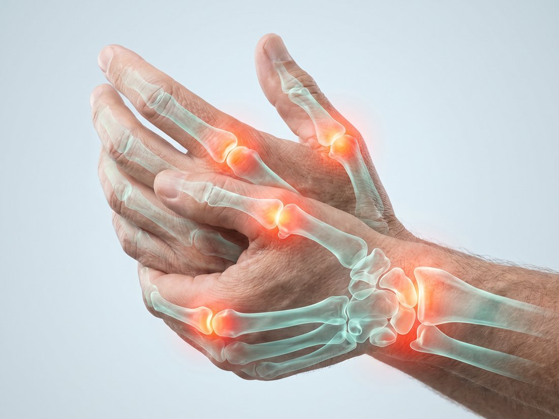 Joint Pain